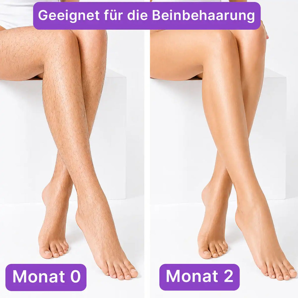Vorher-Nachher Ergebnis von LULU Stop zur Reduzierung der Beinbehaarung nach 2 Monaten